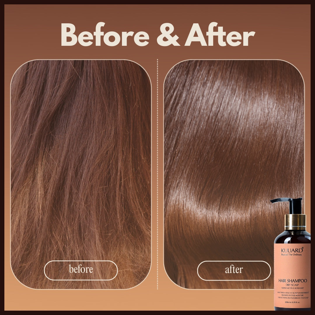 Hair Shampoo For Dry Scalp Amino acids & Rosemary