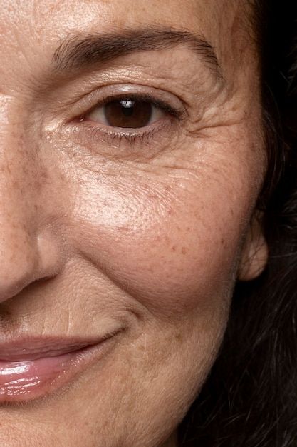 Anti-Aging